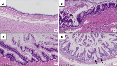 Clinicopathological Features of Low-Grade Appendiceal Mucinous Neoplasms Confined to the Appendix